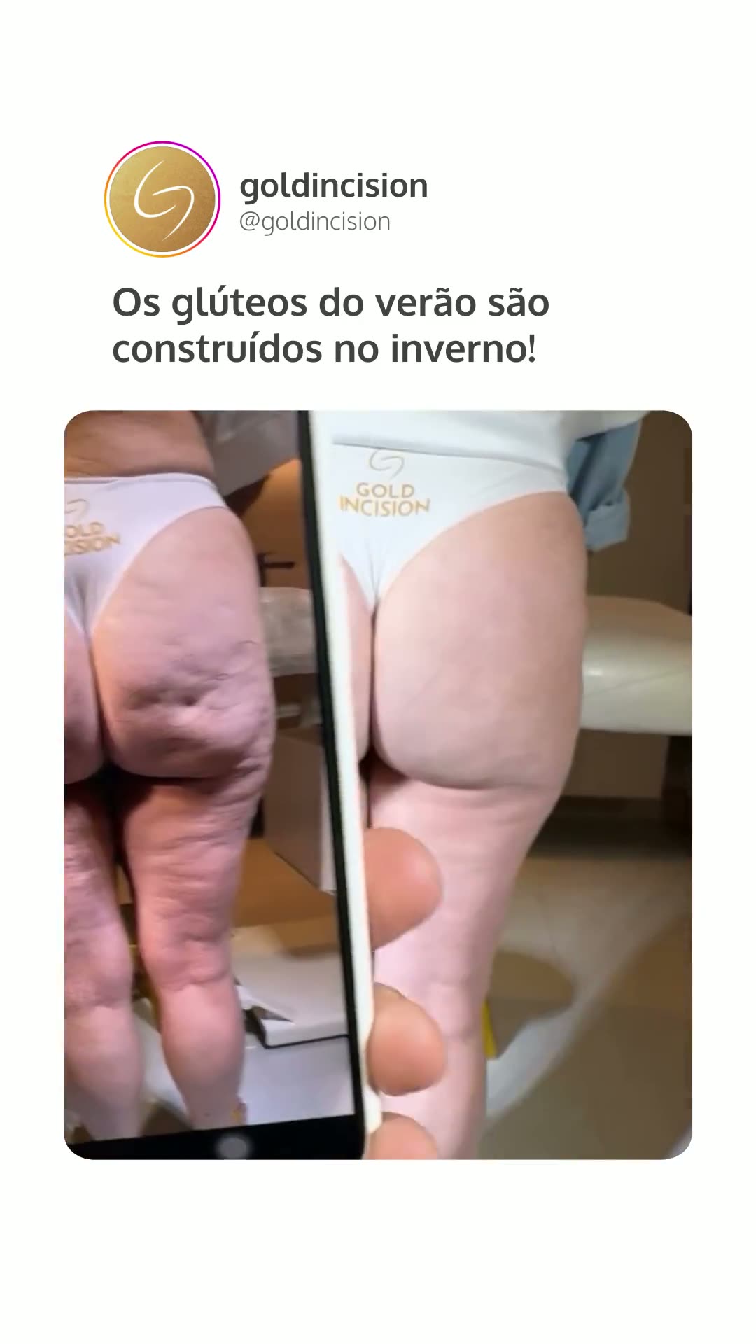 Miniatura do vídeo: Dr. Roberto Chacur, criador do método
